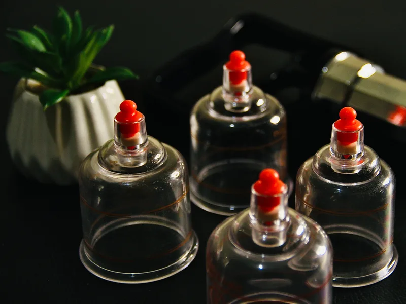 How Cupping Therapy works at Demo Chiropractic