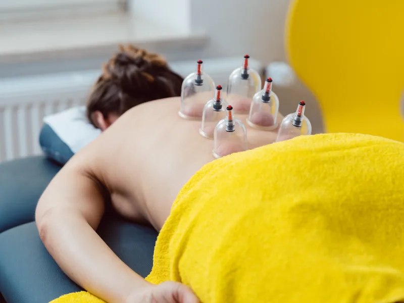 Cupping Therapy at Demo Chiropractic in Demo City