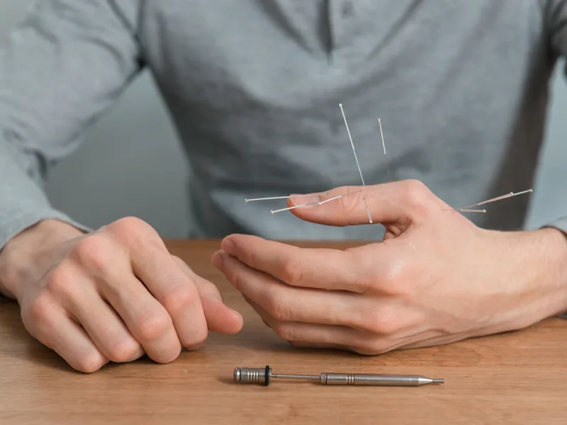 Dry Needling at Demo Chiropractic in Demo City